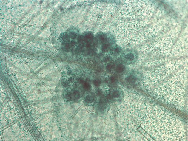 Fern Sori Slides - Fern Sori 04 100X
